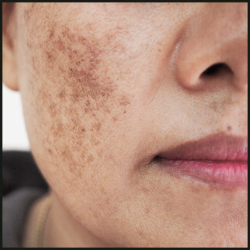 Recovery Facial Oil 50ml for Hormonal & Menopausal skin Natural