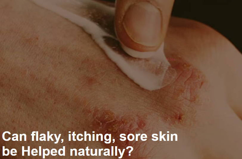 Eczema: Can flaky, itching, sore skin  be Helped naturally?