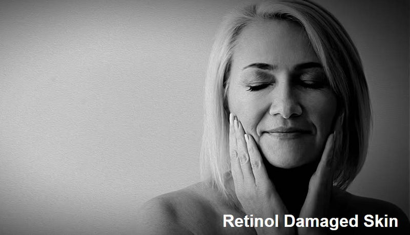 Retinol Damaged Skin - A Natural Guide to Healing