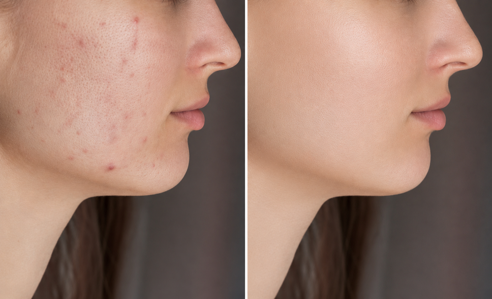 Before and After Results