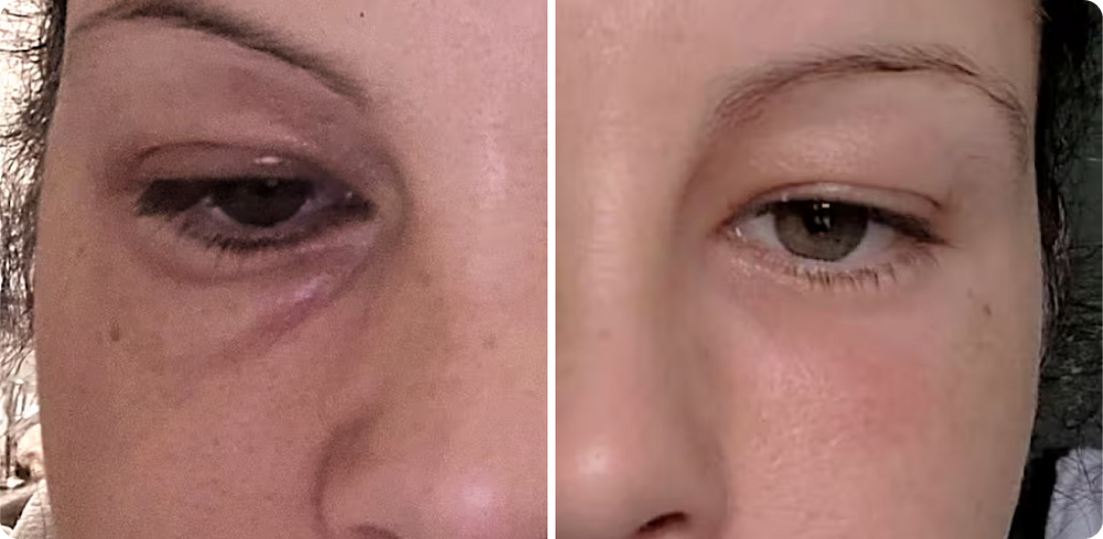 Before and After Results