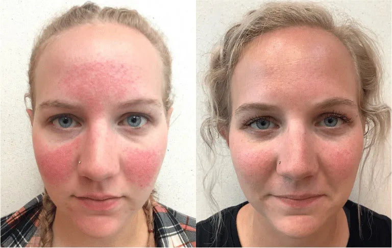 Before and After Results